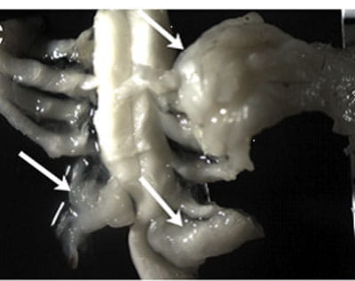 Identification of Molecular and Cellular Contributions to Neurofibroma Formation and Growth: The role of Schwann cells