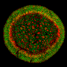 Liver organoid image.