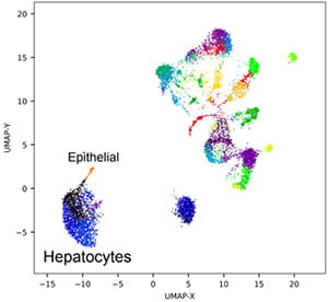hepatic-visual1-200