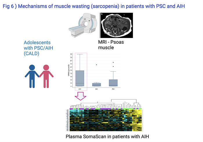 Investigating the Relationship Between Clinical Markers and Liver Disease