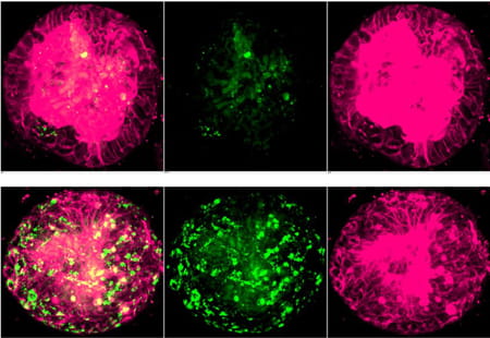 Figure 3: Human fatty liver organoid model in vitro.
