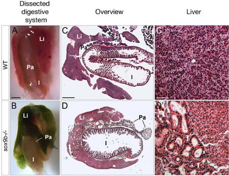 biliary-visual2-450