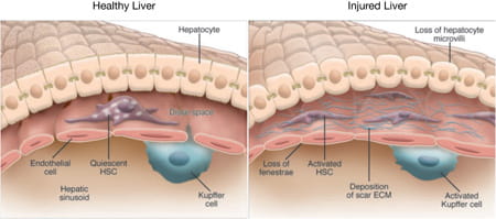 hepatic-visual1-450