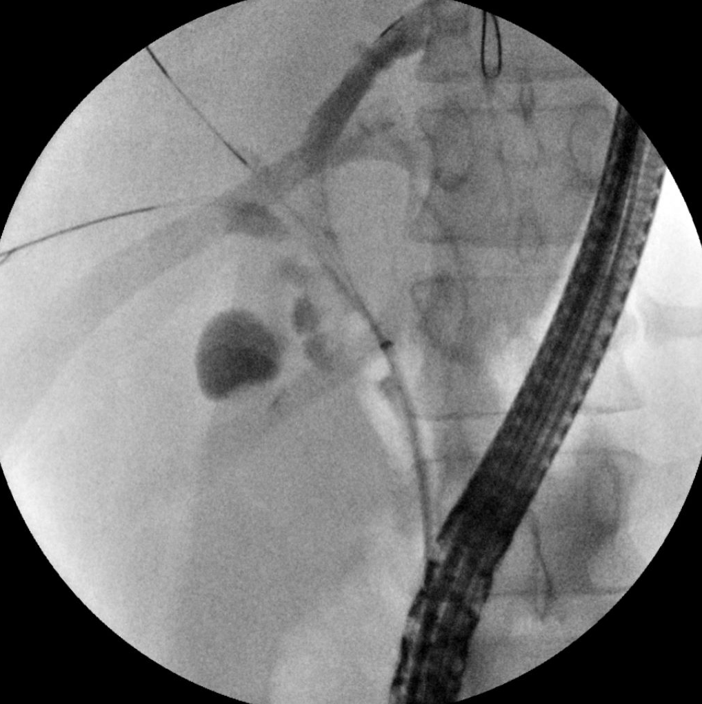 Interventional endoscopy slide image.