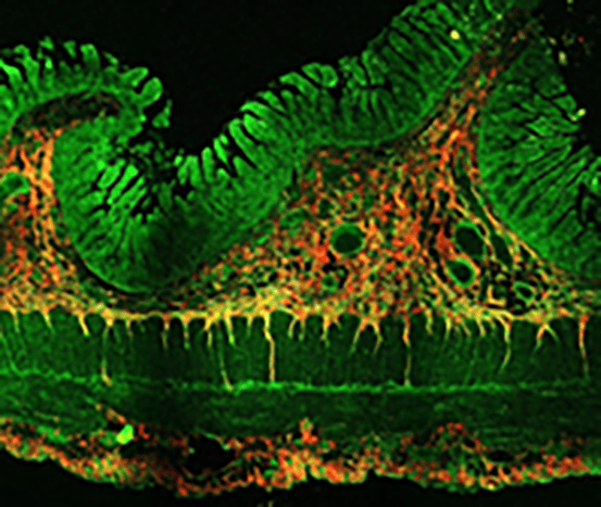 Gastrointestinal tract slide image.