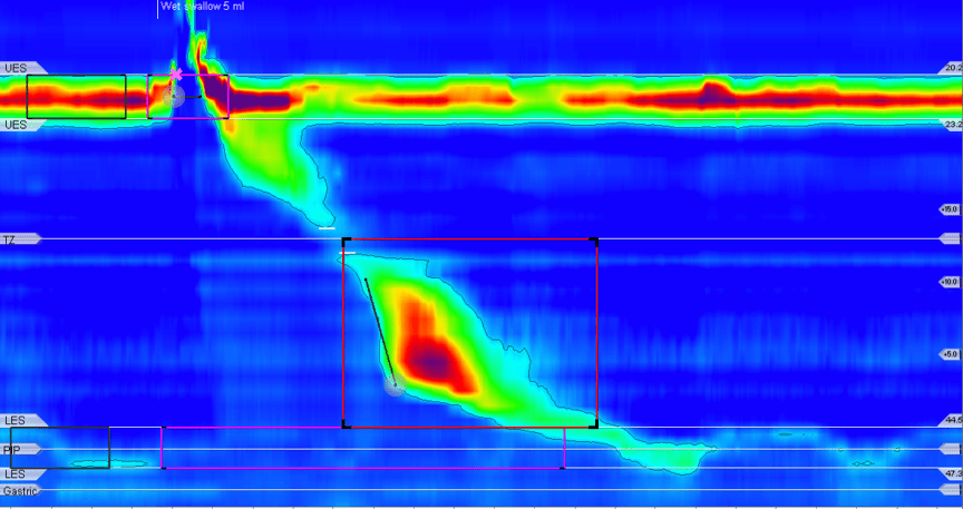 Neurogastroenterology slide image.