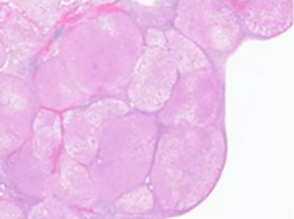 Obesity and nutrition slide image.