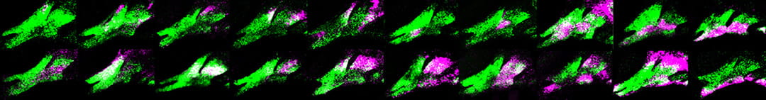 Complex patterns of gene expression in the pharyngeal arches give rise to complex skeletal shapes in the skull. Primary investigator Lindsey Barske uses zebrafish models in her human genetics lab at Cincinnati Children's.