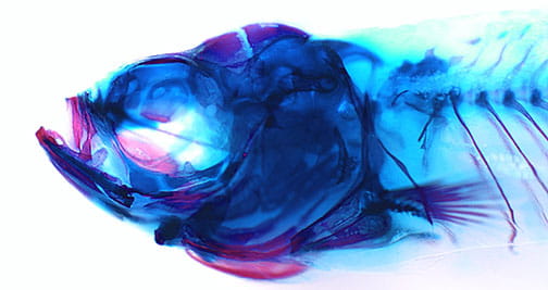 There are 74 bones in the zebrafish skull but only 22 in humans. Primary investigator Lindsey Barske uses zebrafish models in her human genetics lab at Cincinnati Children's.