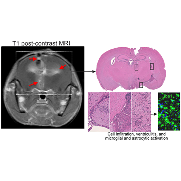 Integrated Platforms for Pulmonary and TB Meningitis Research