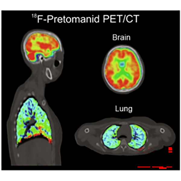 Imaging to study antimicrobials pharmacokinetics.