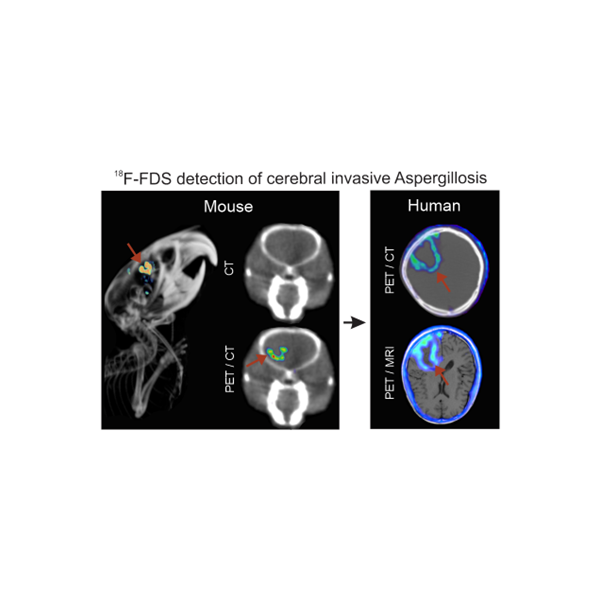 Developing molecular imaging approaches to diagnose and monitor infections anywhere in the body.