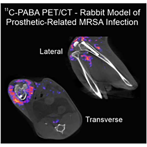 New Regimens for S. aureus Implant-Associated Infections.