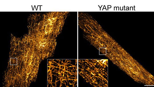 A super-resolution image shows the changed cardiac cytoskeleton structure in CMs with YAP mutation.