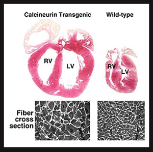 Calcineurin transgenic versus wild-type.