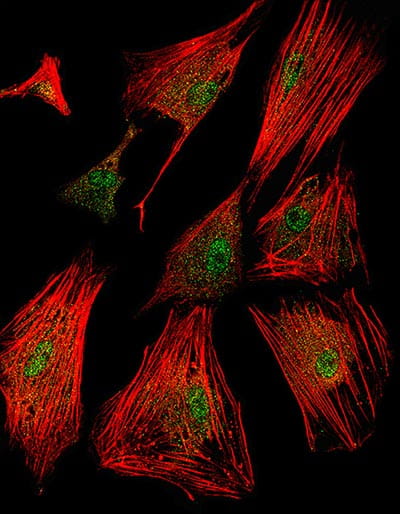 The laboratory is interested in understanding how fibroblasts convert into myofibroblasts during disease stimulation to help mediate tissue remodeling.
