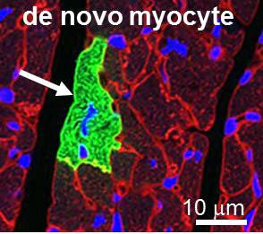 The laboratory is interested in cardiac regeneration after myocardial infarction.
