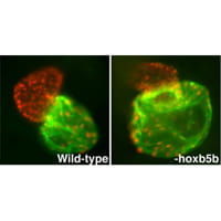 Wild-type heart versus heart with inhibited hoxb5b.