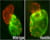 Wild-type heart versus heart with inhibited hoxb5b.