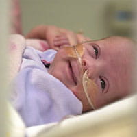 A premature baby in the Newborn Intensive Care Unit.