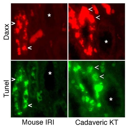 Immunofluorescence images of kidneys.