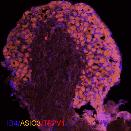 Dorsal root ganglion from an MDX mouse.