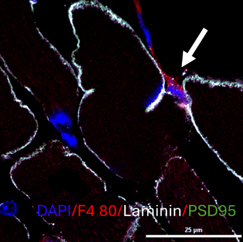 Macrophages infiltrate the muscles to make synaptic-like contacts with myofibers.