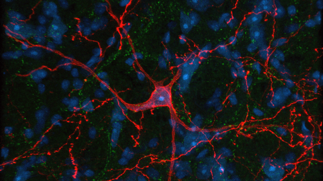 A microscopic image showing a V2a neuron transduced with an adeno-associated virus (AAV).