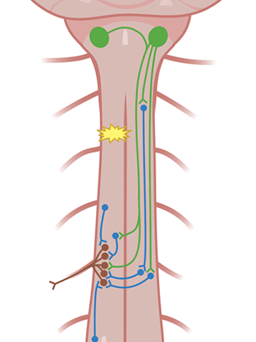 An illustration of cervical spinal cord injuries.