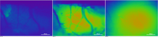 An image of a brain tsunami spreading across a mouse brain.