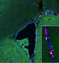 Proliferation of stem cells in the germinal zone of brain in an old mouse.