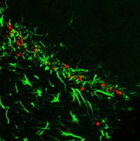 Proliferating cells in the brain of an old mouse expressing stem cell and glial markers.