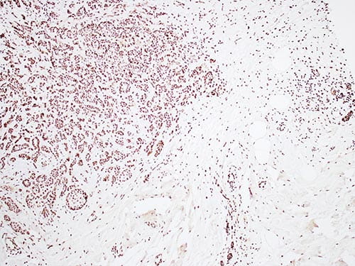 dek oncogene-visual1-500