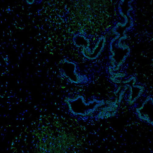 dek oncogene-visual2-500