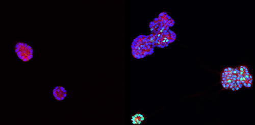 dek oncogene-visual3-500