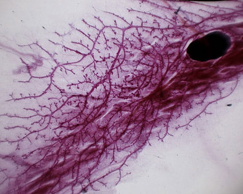 dek oncogene-visual4-500