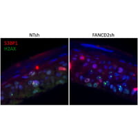 DNA damage markers.