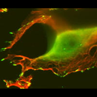 HPV positive cell.