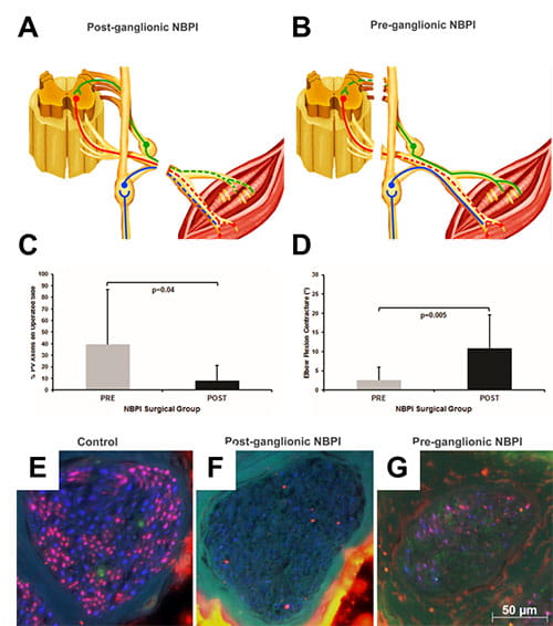 Afferent-visual1-figure5-450