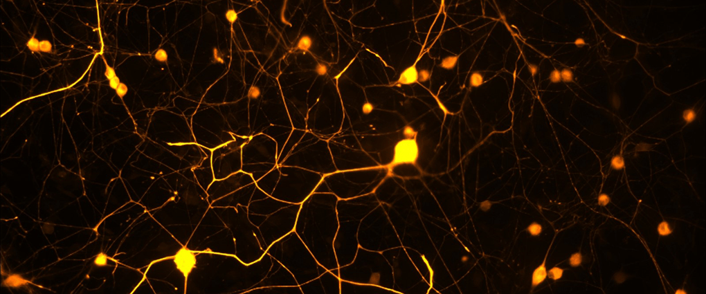 An image of dissociated primary sensory neurons growing in vitro.