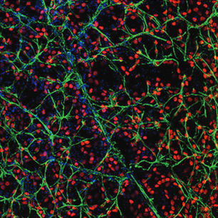 An image of a healthy mouse retina.