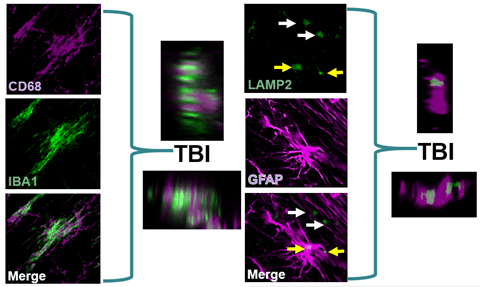 An image of the brain's immune cells.
