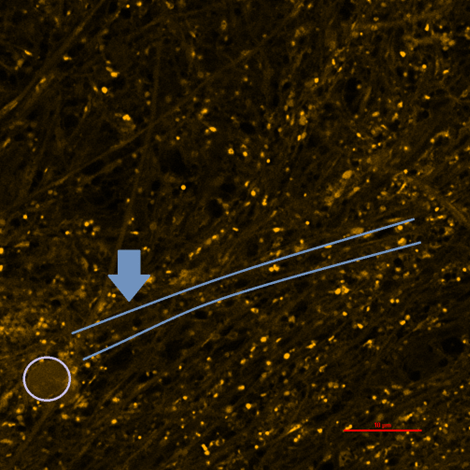 A confocal image showing high levels of mitochondrial superoxide.