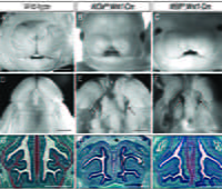 Primary cilia in patterning the facial midline image.