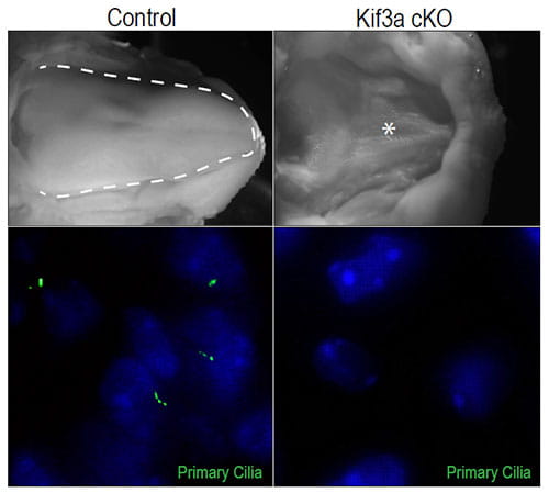 Loss of the ciliary protein Kif3a on cranial neural crest cells results in aglossial. Dorsal view of the developing tongue in control and ciliopathic (Kif3a cKO) embryos. Tongue is outlined in dotted white line in control. Lack of tongue is denoted by white asterisk in the mutant.