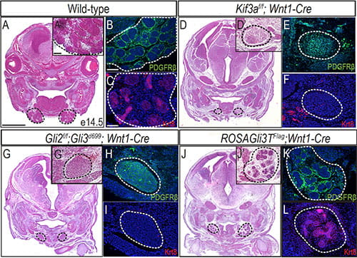 GLI activator and repressor activity have differential requirements in the NCCs of the developing mandibular prominence.