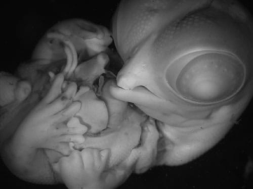 Whole mount image of a day 10 talpid2 mutant embryo.