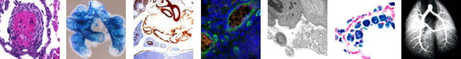 Pulmonary Biology Research.