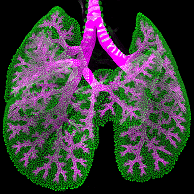 Imaging of lungs.