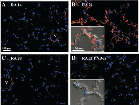 Alveolar aSMA expression is induced one week after completion of retinoic acid (RA) treatment.
